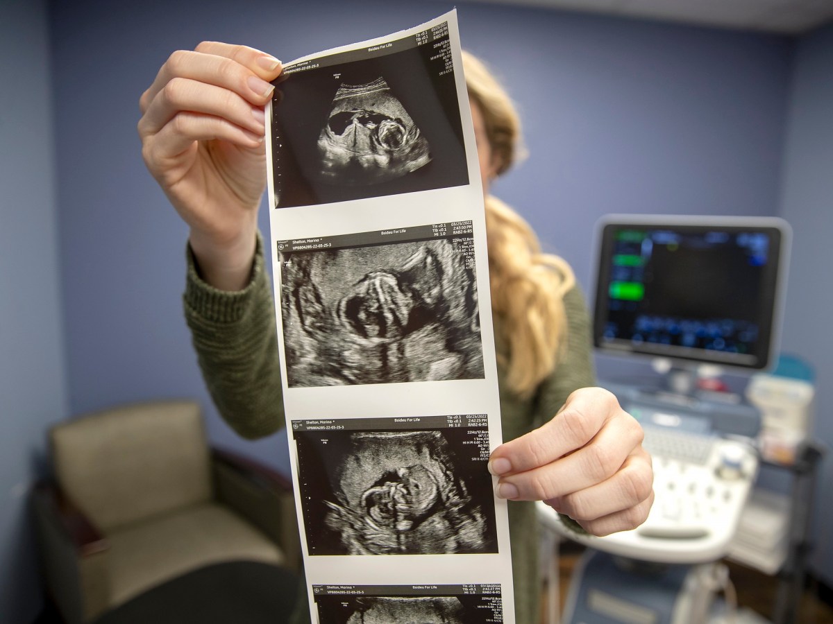 Pro-life After January